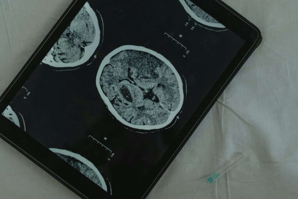 Radiology scan Aidoc